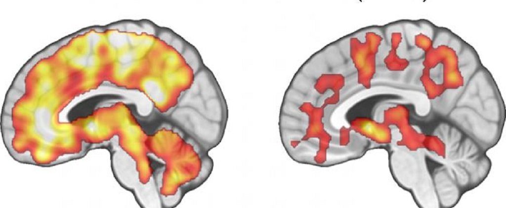 comfort food, dopamine brain