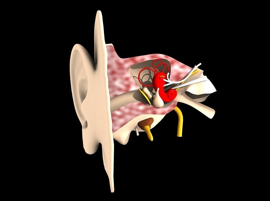 Tinnitus and the Brain 3D Mapped Trebuchet